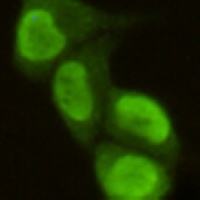 PRMT6 Mouse Monoclonal Antibody