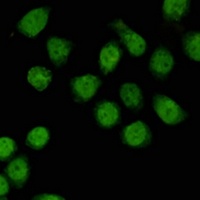 TBL1X Mouse Monoclonal Antibody