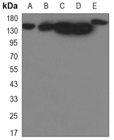 YTHDC2 Rabbit Monoclonal Antibody