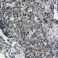 RSK2 Rabbit Monoclonal Antibody
