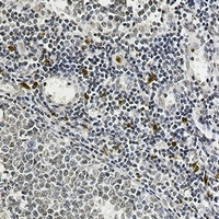IL-26 Antibody