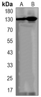 DNMT3A Rabbit Monoclonal Antibody