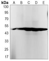 Cytochrome P450 2D6 Rabbit Monoclonal Antibody