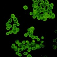 Cytochrome P450 2D6 Rabbit Monoclonal Antibody