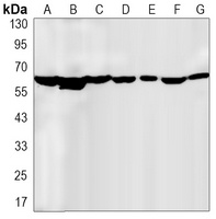 CCT2 Rabbit Monoclonal Antibody