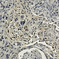 CCT2 Rabbit Monoclonal Antibody