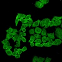 CCT2 Rabbit Monoclonal Antibody