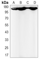 BCR Rabbit Monoclonal Antibody