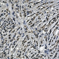 BCR Rabbit Monoclonal Antibody
