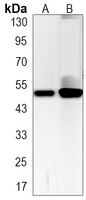 p53 (Phospho-S6) Antibody