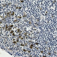 p53 (Phospho-S6) Antibody