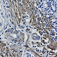 Filamin A/B (Phospho-S2152/2107) Antibody