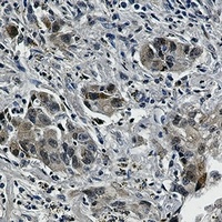 EGFR (Phospho-Y1173) Antibody