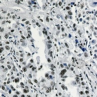 Histone H3 (Acetyl-K27) Antibody