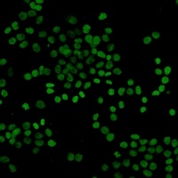Histone H3 (Acetyl-K27) Antibody