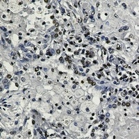 Histone H3 (TriMethyl-K27) Antibody