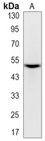 Vimentin (Phospho-S56) Antibody