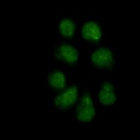 Vimentin (Phospho-S56) Antibody