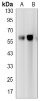 TCF7L2 Rabbit Monoclonal Antibody