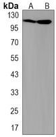 UPF1 Rabbit Monoclonal Antibody