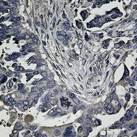 UPF1 Rabbit Monoclonal Antibody