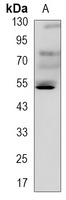 p53 Rabbit Monoclonal Antibody