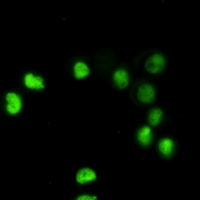 p53 Rabbit Monoclonal Antibody