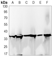 GAPDH Rabbit Monoclonal Antibody