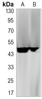 CD95 Antibody