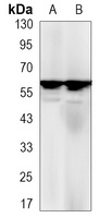 Estrogen Receptor alpha Rabbit Monoclonal Antibody