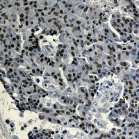 Estrogen Receptor alpha Rabbit Monoclonal Antibody