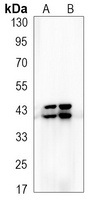 ERK1/2 (Phospho-T202/Y204) Rabbit Monoclonal Antibody
