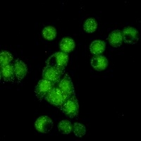 Cyclin E2 Rabbit Monoclonal Antibody