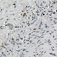 CREB (Phospho-S133) Antibody