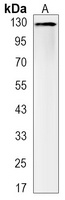 CD31 Rabbit Monoclonal Antibody