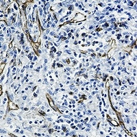 CD31 Rabbit Monoclonal Antibody