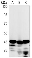 Cathepsin B Rabbit Monoclonal Antibody