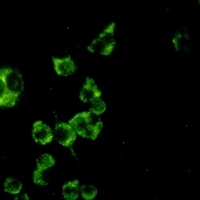 Cathepsin B Rabbit Monoclonal Antibody