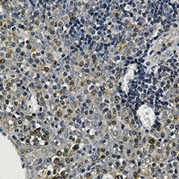 Alpha-tubulin 4a Rabbit Monoclonal Antibody