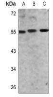 AKT (Phospho-S473) Rabbit Monoclonal Antibody