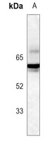 SMAD2 (Phospho-S255) Antibody