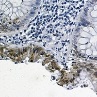 SMAD2 (Phospho-S255) Antibody