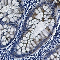 GSK3 beta (Phospho-S9) Antibody