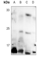 4EBP1 (Phospho-T46) Antibody