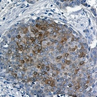 4EBP1 (Phospho-T46) Antibody