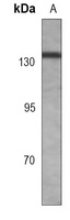RB2 (Phospho-T986) Rabbit Monoclonal Antibody