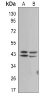 ERK1/2 (Phospho-T202/T185) Rabbit Monoclonal Antibody