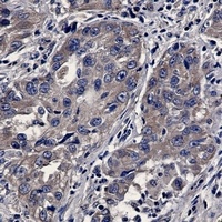 BAX Antibody