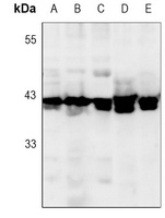 ERK1/2 Rabbit Monoclonal Antibody