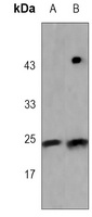 TCF6 Rabbit Monoclonal Antibody